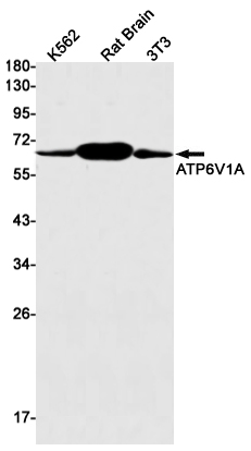 ATP6V1A