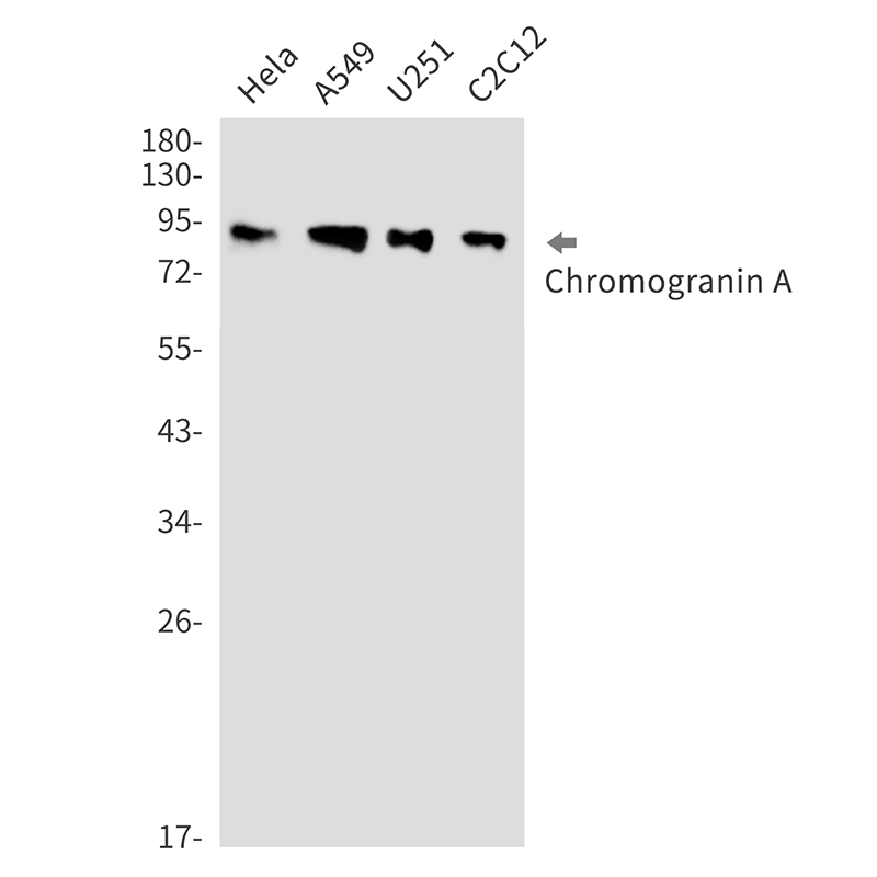 Chromogranin A