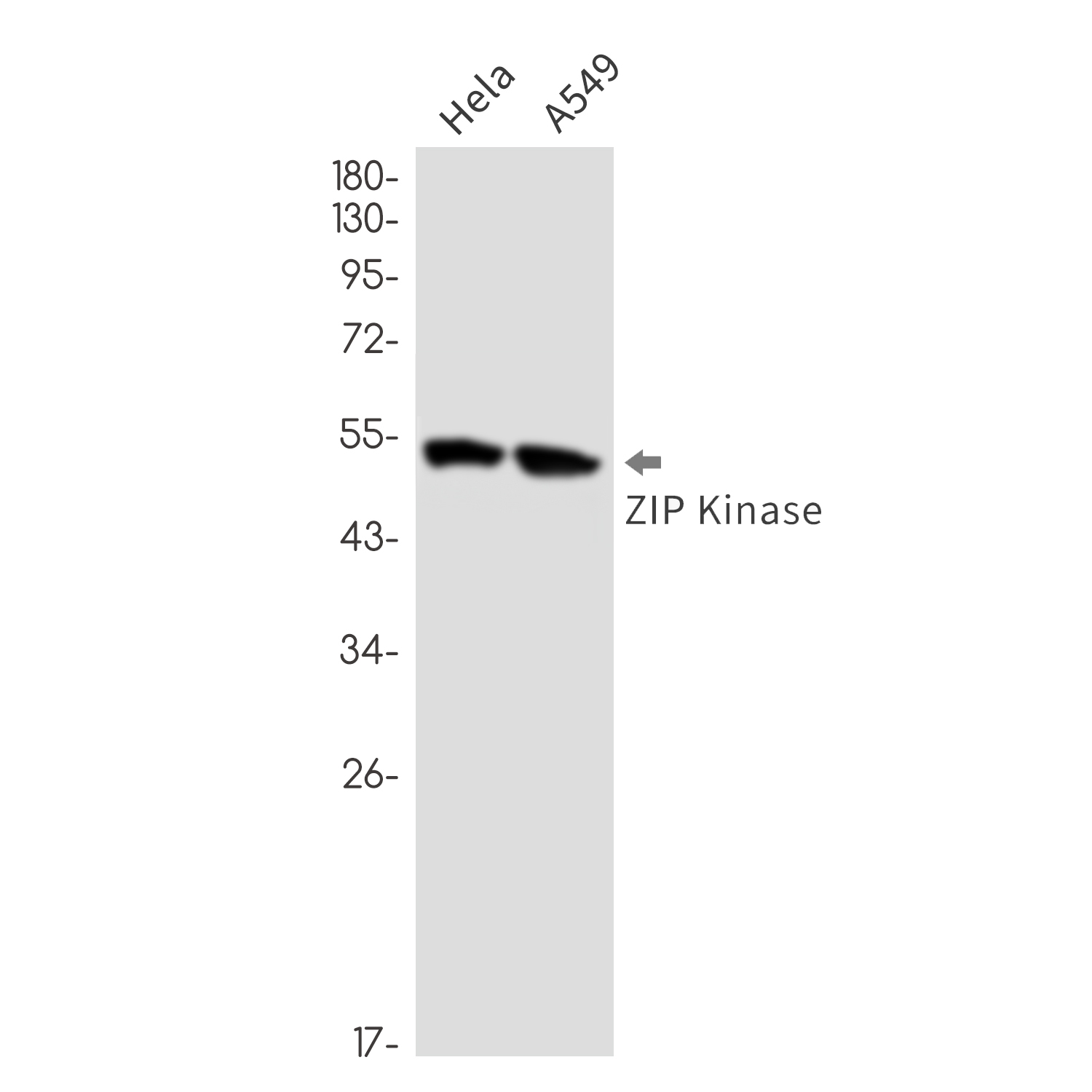DAP kinase 3