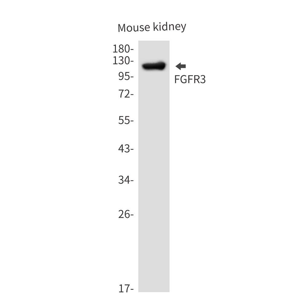 FGFR3