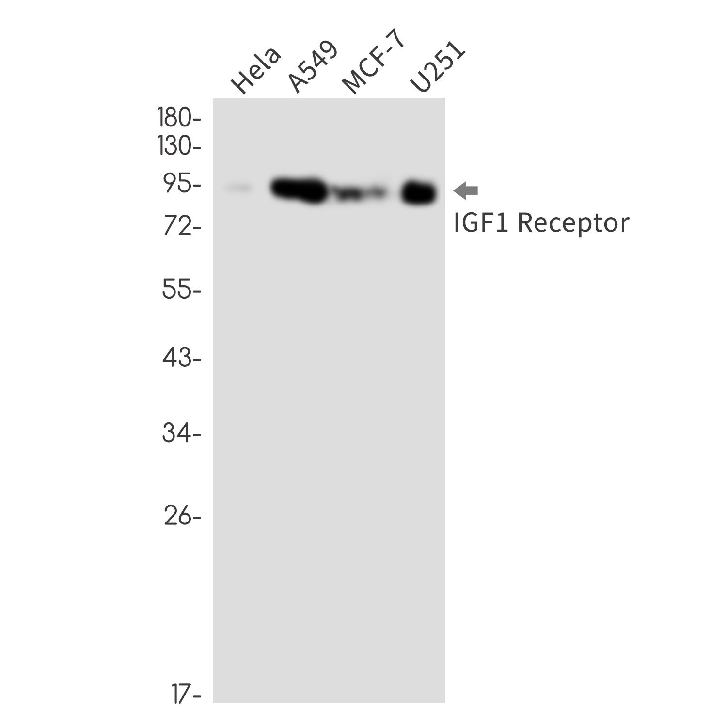IGF1 Receptor