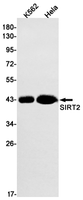 SIRT2