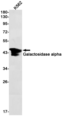 Galactosidase alpha