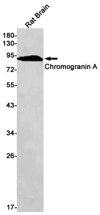 Chromogranin A