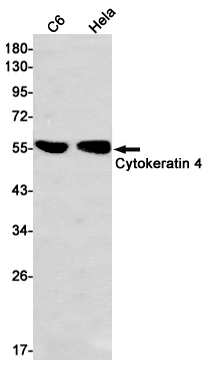 Cytokeratin 4