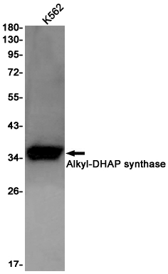 Alkyl~DHAP synthase
