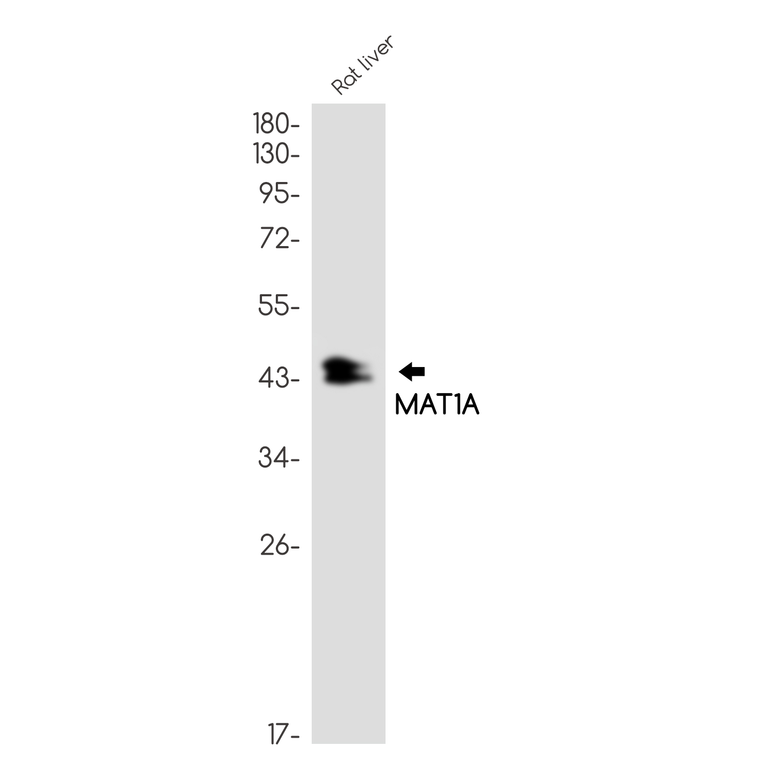 MAT1A