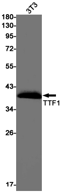 Thyroid Transcription Factor 1