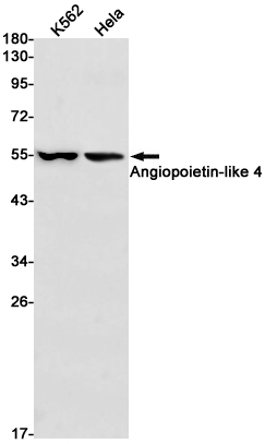 Angiopoietin~like 4