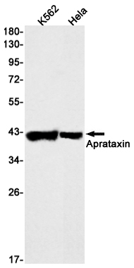 Aprataxin