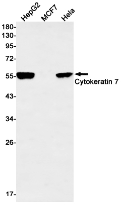 Cytokeratin 7