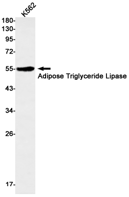 Adipose Triglyceride Lipase