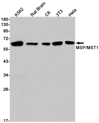 Serine/threonine~protein kinase 4