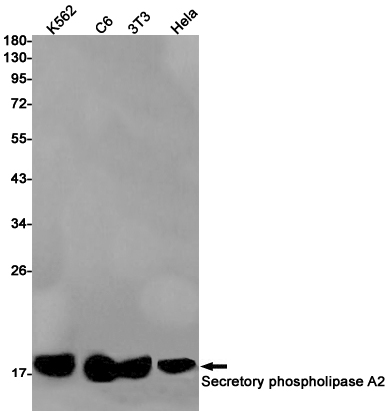 Secretory phospholipase A2