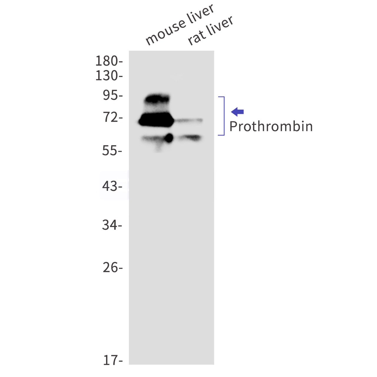 Prothrombin