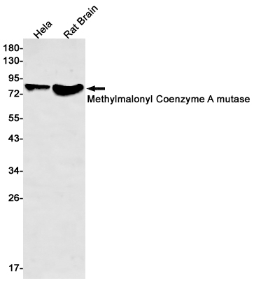 Methylmalonyl Coenzyme A mutase