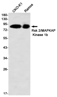 RSK2