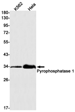 Pyrophosphatase 1