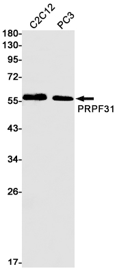 PRPF31