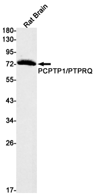 PCPTP1