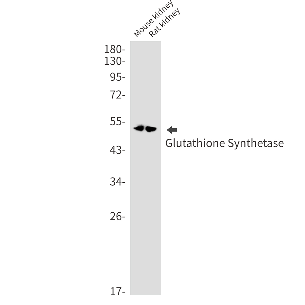 Glutathione Synthetase