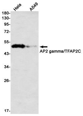 Transcription Factor AP 2 gamma