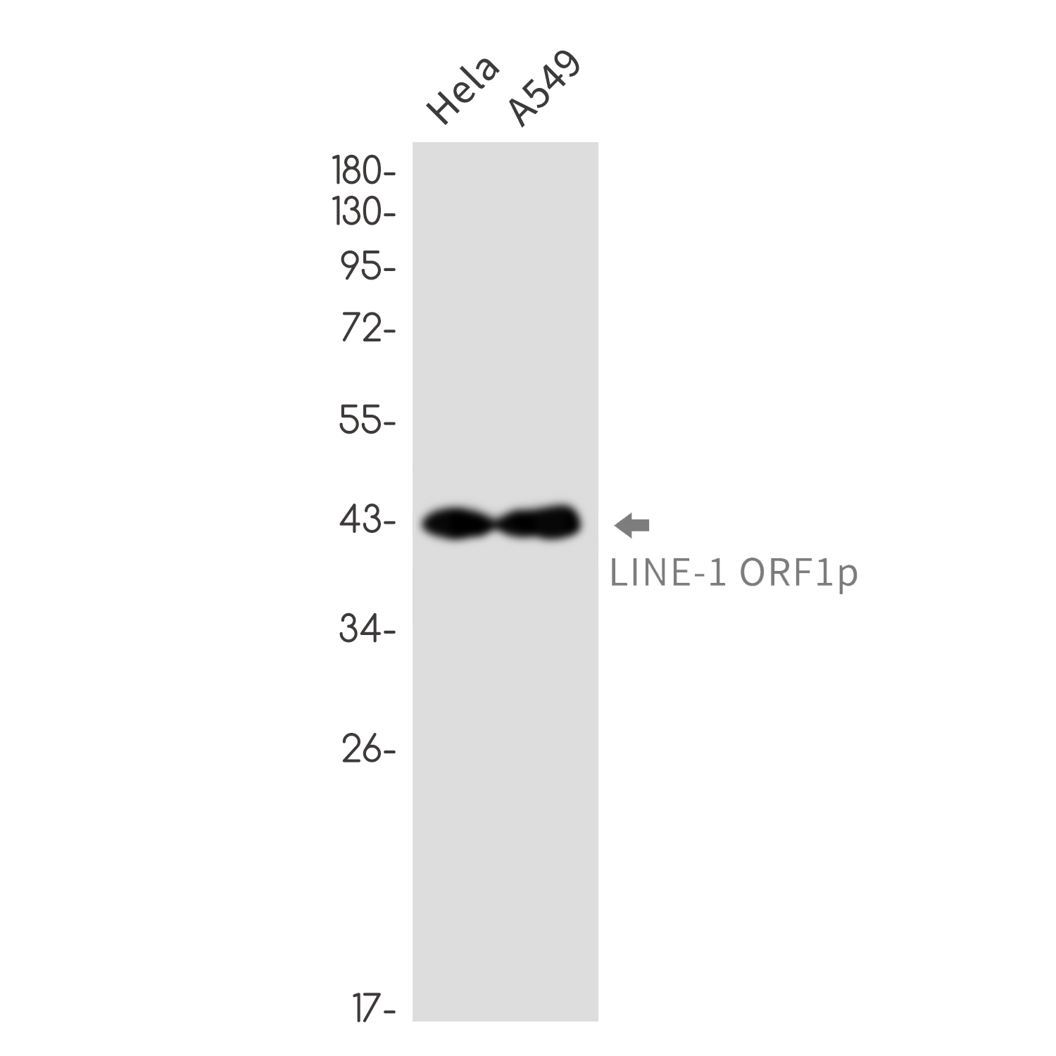 LINE 1 ORF1p