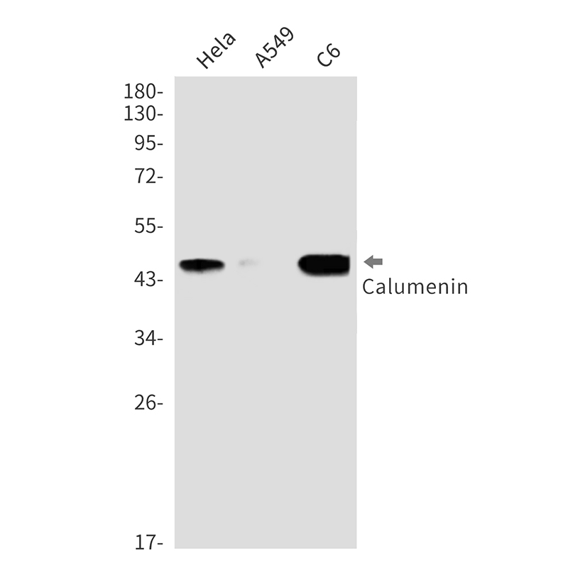 Calumenin