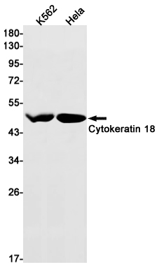 Cytokeratin 18