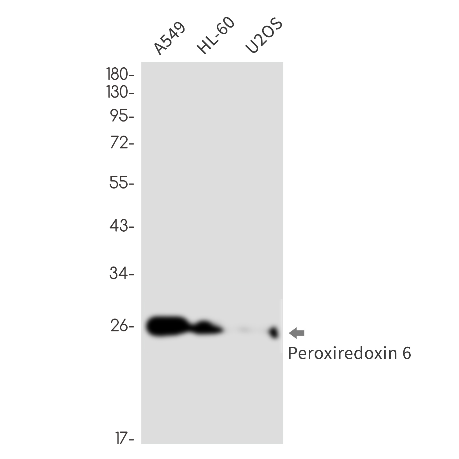 Peroxiredoxin 6
