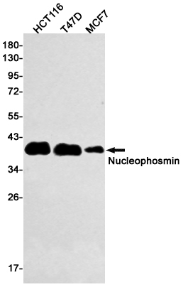 Nucleophosmin