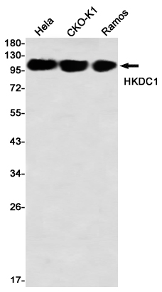HKDC1