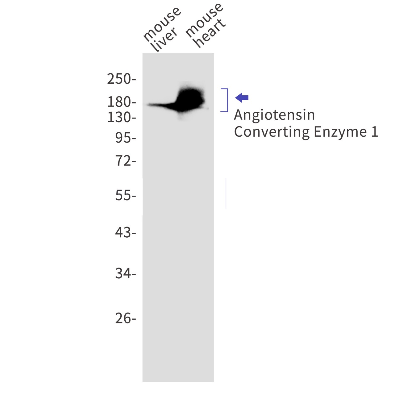 Angiotensin Converting Enzyme 1