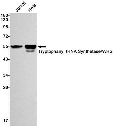 Tryptophanyl tRNA synthetase