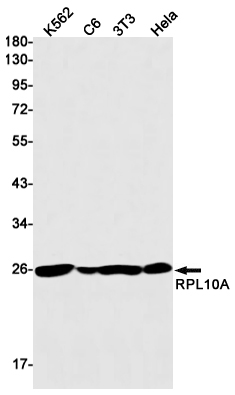 RPL10A