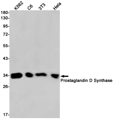 Prostaglandin D Synthase