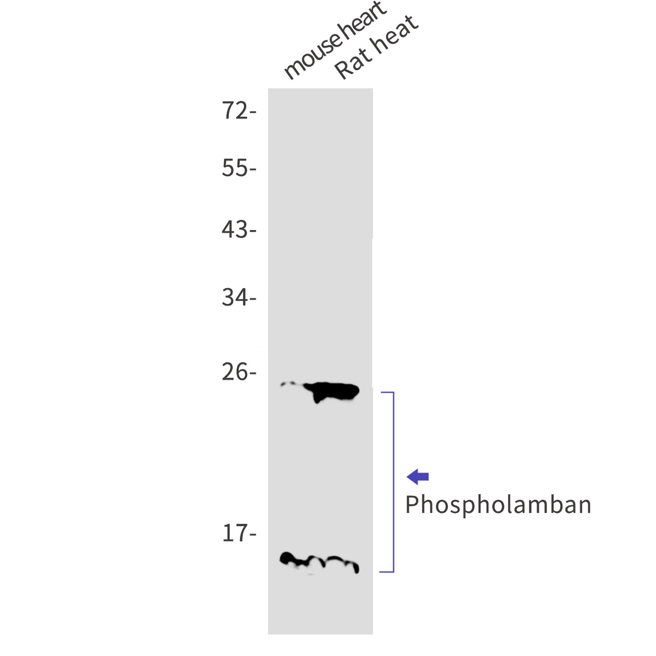 Phospholamban