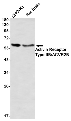 Activin Receptor Type IIB