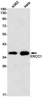 ERCC1