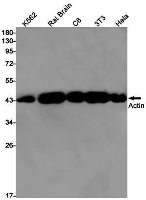alpha Skeletal Muscle Actin
