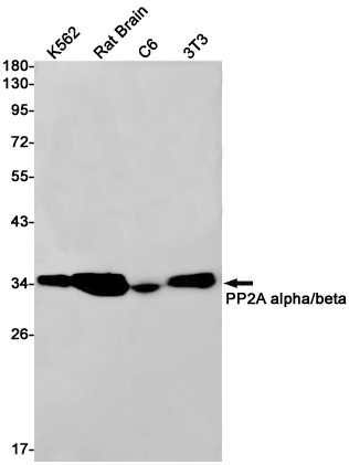 PP2A alpha/beta