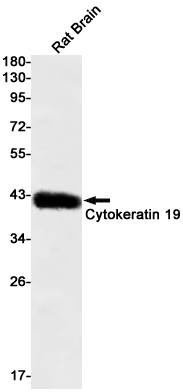 Cytokeratin 19