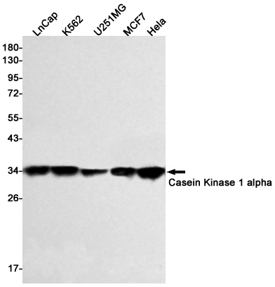 Casein Kinase 1 alpha
