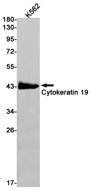 Cytokeratin 19