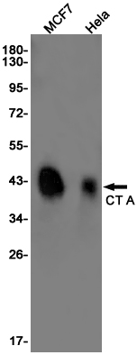 PCYT1A