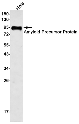 Amyloid Precursor Protein