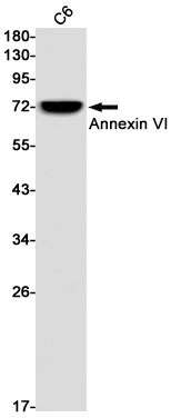 Annexin VI
