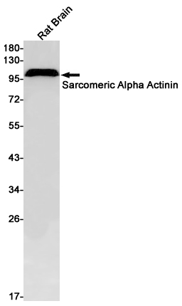 Sarcomeric alpha Actinin