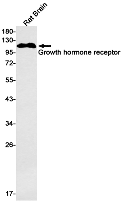 Growth Hormone Receptor