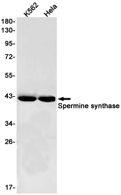 Spermine synthase